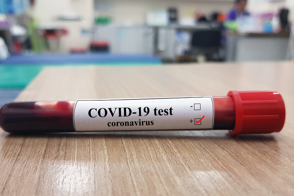 covid19-pcr